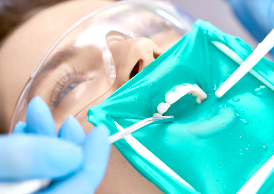 ラバーダム防湿の重要性